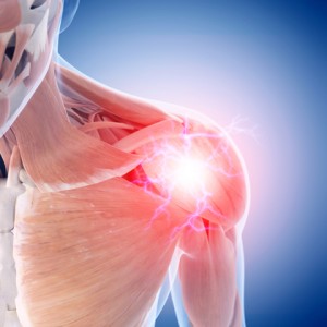 Physical Therapy and the Shoulder Joint Replacement: Returning to the highest level of function